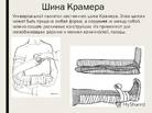 Шина транспортная д/нижней конечности (типа Крамера) - фото 4