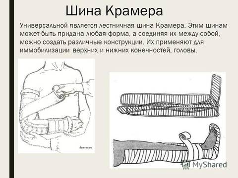 Шина транспортная д/нижней конечности (типа Крамера) - фото 4